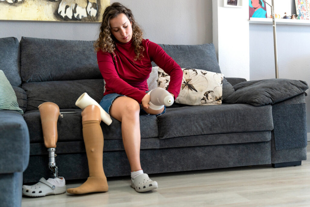 Woman with a prosthetic leg sitting on a sofa, preparing her prosthesis
